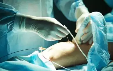 vascular surgery